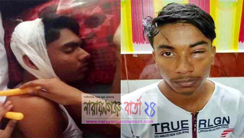 বন্দরে ৩ স্কুল শিক্ষার্থীকে কুপিয়েছে সহপাঠিরা