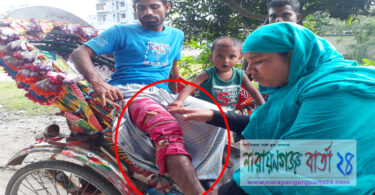 আড়াইহাজারে মামলা তুলে না নেয়ায় বাদীকে পিটিয়ে আহত