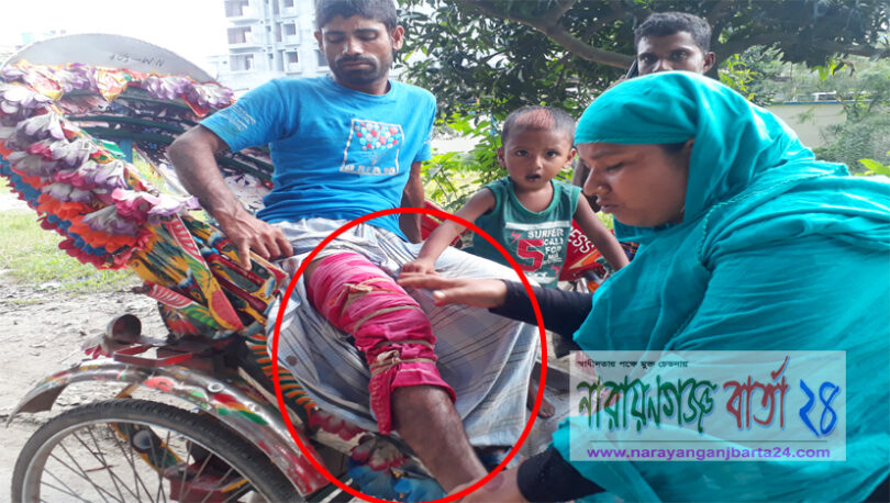 আড়াইহাজারে মামলা তুলে না নেয়ায় বাদীকে পিটিয়ে আহত