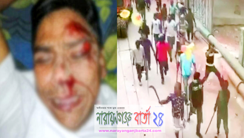 রূপগঞ্জে ফের কলি বাহিনীর তাণ্ডব, ব্যবসায়িকে কুপিয়ে জখম