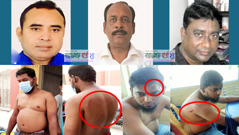 হা‌জী রিপন, কাউ‌ন্সিলর শ‌ফি ও হারু‌ন গ‌্যাং‌য়ের হামলায় সাংবা‌দিক আহত
