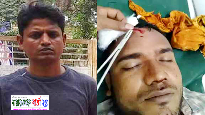বন্দরে সন্ত্রাসী হামলায় হোসিয়ারী শ্রমিক জখম