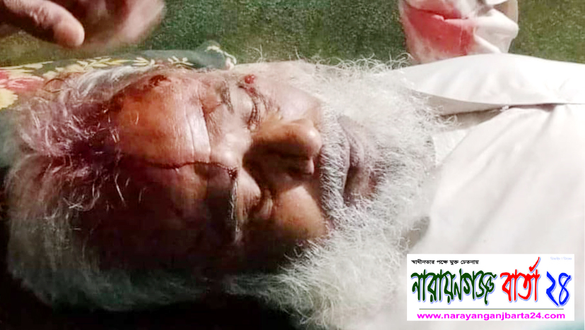 রূপগঞ্জে আওয়ামীলীগ নেতাকে কুপিয়ে জখম