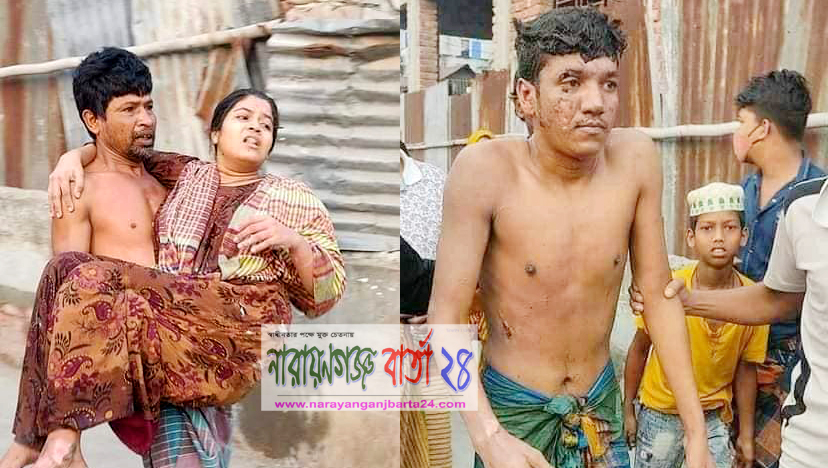 নারায়ণগঞ্জে গ্যাস লাইন বিস্ফোরণে শিশুসহ দগ্ধ ১১, ঢাকায় ভর্তি ৫