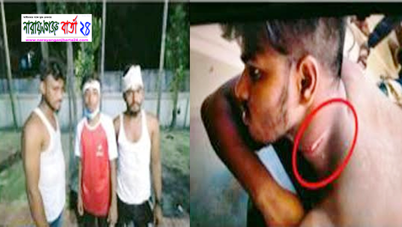 বন্দরে ইভটিজিংয়ের প্রতিবাদ করায় কিশোর গ্যাংয়ের হামলা, থানায় মামলা