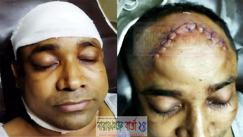 রূপগঞ্জে সাংবাদিক রিয়াজের উপর সন্ত্রাসী হামলা