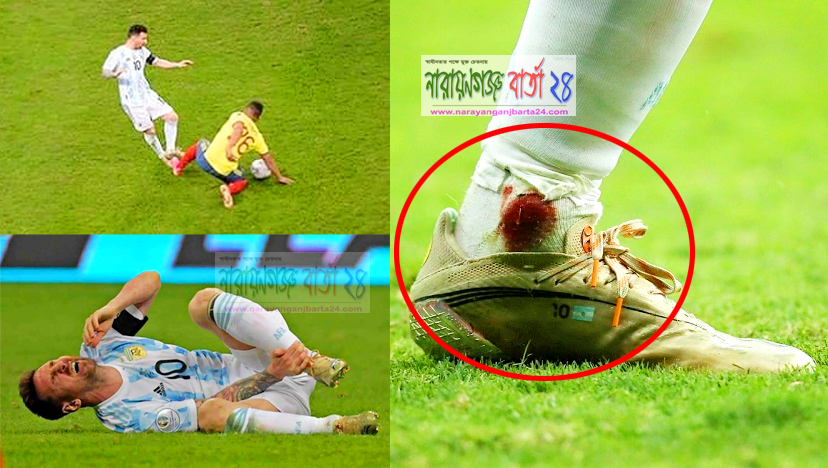 পা থেকে ঝরছিল রক্ত, ব্যান্ডেজ বেধেই দলকে ফাইনালে তুললেন মেসি