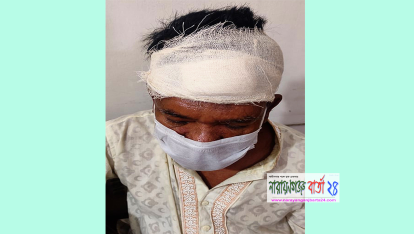 সিদ্ধিরগঞ্জে ভাইয়ের কোপে ভাই আহত