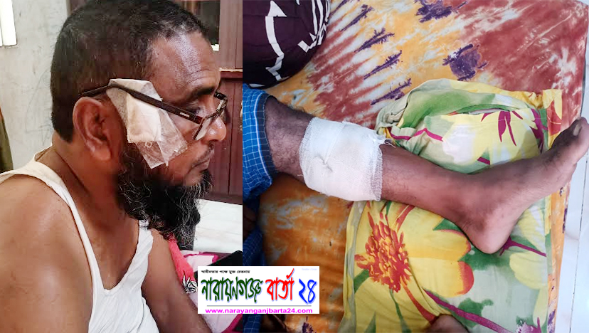ফতুল্লায় সন্ত্রাসীদের হামলায় কন্ট্রাক্টর গুরুতর আহত