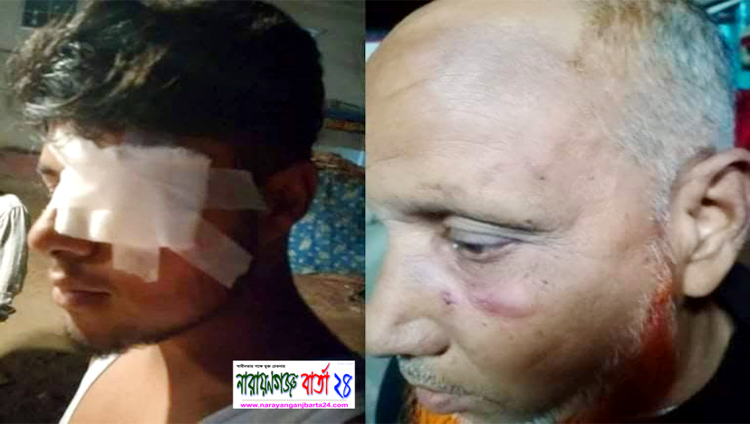 মেয়েকে উগ্র চলাফেরায় বাঁধা : জামাইয়ের বাড়িতে কনের পরিবারের হামলা