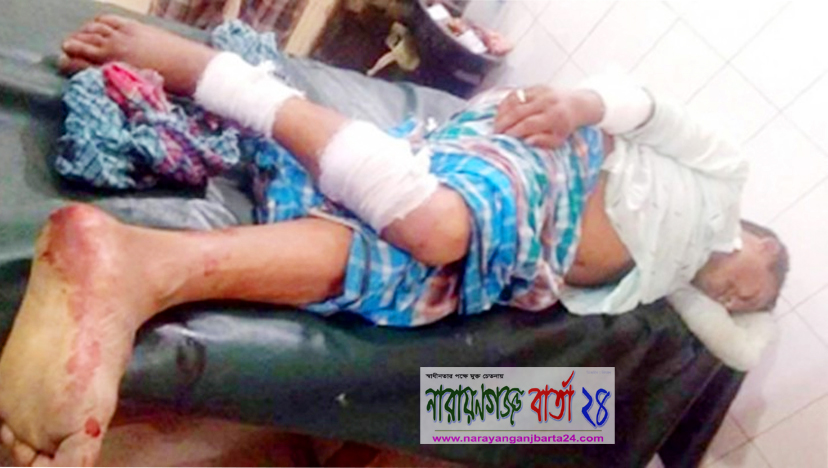 আড়াইহাজারে ইউপি সদস্যকে কুপিয়ে টাকা ছিনতাই