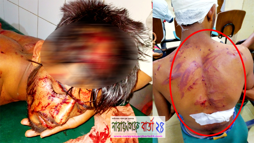 সন্ত্রাসী হামলায় বন্দরে এক যুবককে রক্তাক্ত জখম