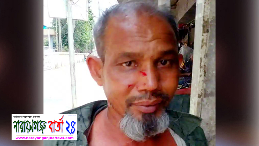 পাষন্ড ছেলের লাঠির আঘাতে আহত পিতা