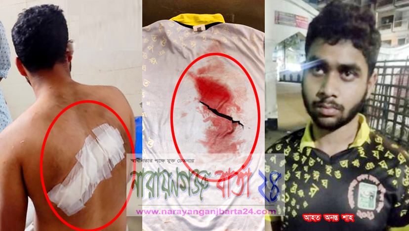 সাংবাদিক পুত্রকে ছুরিকাঘাত, গ্রেফতার ৩