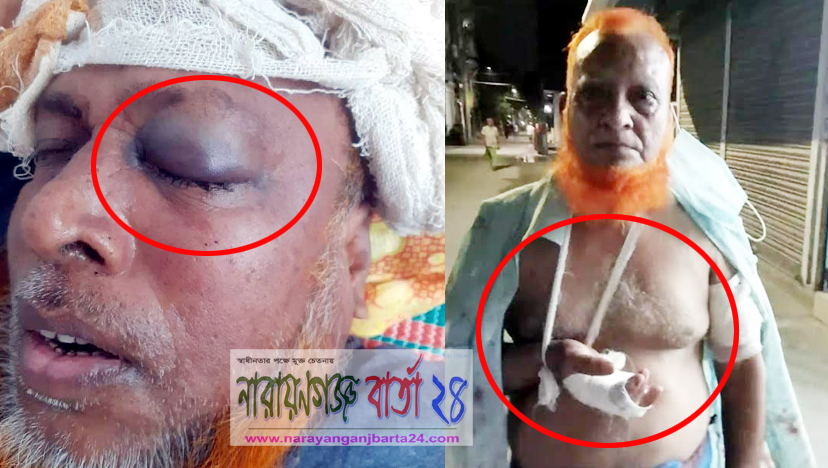 আ.লীগ নেতার বাড়িতে হামলা, বীর মুক্তিযোদ্ধাসহ আহত ৬