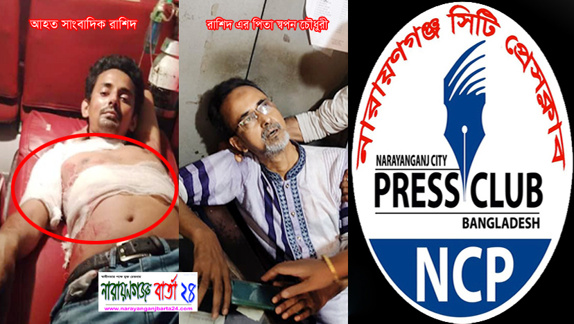 সাংবাদিক রাশিদকে হত্যা চেষ্টাকারীদের দ্রুত গ্রেপ্তার চাইলো সিটি প্রেসক্লাব