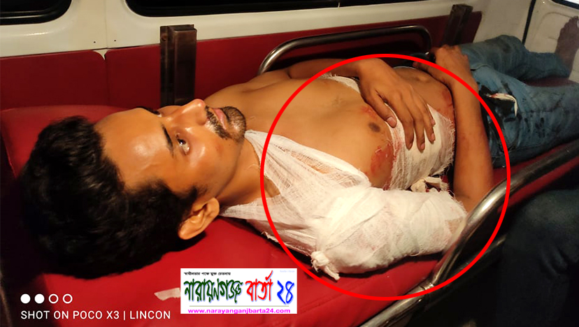 কিশোর গ্যাংয়ের হামলায় গুরুতর আহত সাংবাদিক রাশিদ