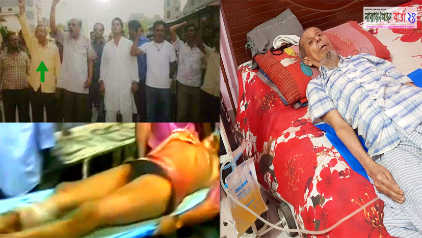 বোমা হামলায় আহত সেই লুৎফর শয‌্যাশায়ী