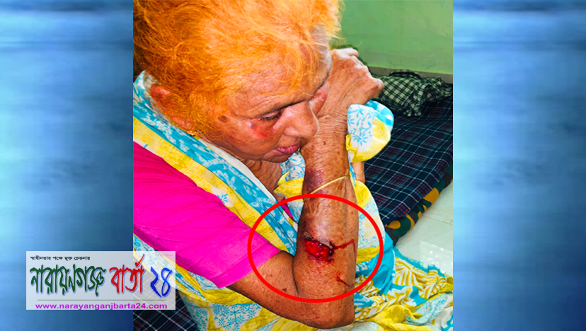 বন্দরে সন্ত্রাসী হামলায় বৃদ্ধা সখিনা জখম